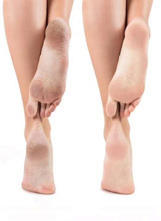 6db1171a7254ec0e061c6efc1fbdcec6